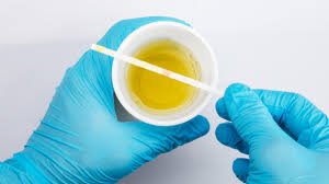 Breakthrough Study Suggests Simple Urine Test May Help Detect Autism in Young Children
