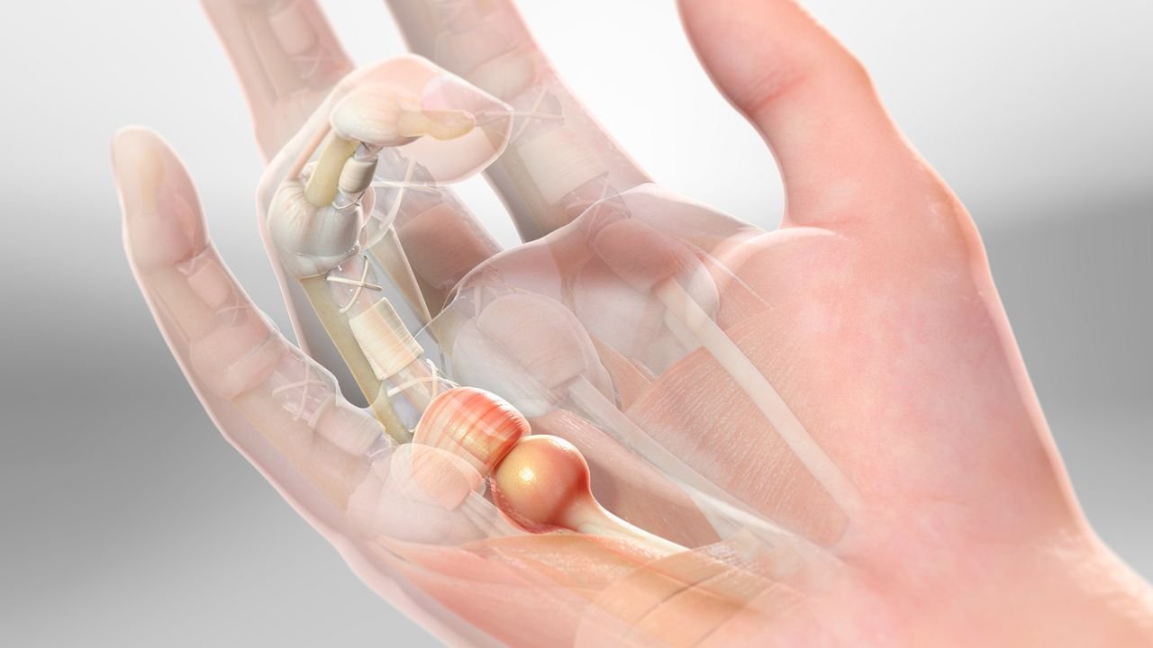 Do Weather Changes Really Trigger Joint Pain? Doctors Explain the Link and Precautions
