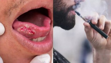 Smoking Habit? Never Ignore These Warning Signs of Oral Cancer