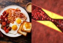 Breakfast Mistakes That Can Raise Bad Cholesterol and Increase Heart Risk Experts Warn