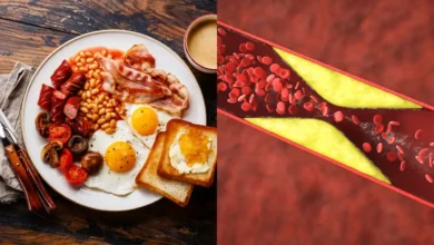 Breakfast Mistakes That Can Raise Bad Cholesterol and Increase Heart Risk Experts Warn