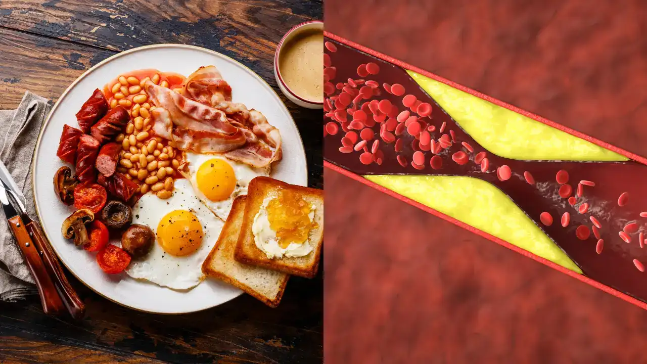Breakfast Mistakes That Can Raise Bad Cholesterol and Increase Heart Risk Experts Warn