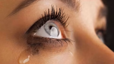 Eyes Watering Again and Again? Know the Causes and When to See a Doctor