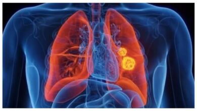 Unexpected Weight Loss And Loss Of Appetite Could Signal Serious Lung Health Issues