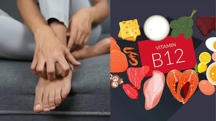 Vitamin B12 Deficiency Can Show Up Through Numbness And Walking Problems