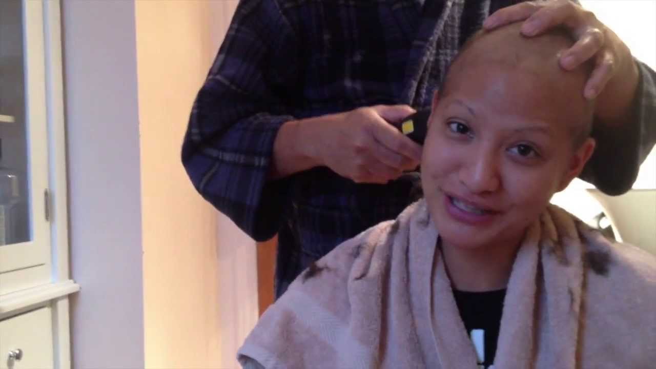 Why Cancer Treatment Causes Hair Loss and What Patients Should Know About Recovery