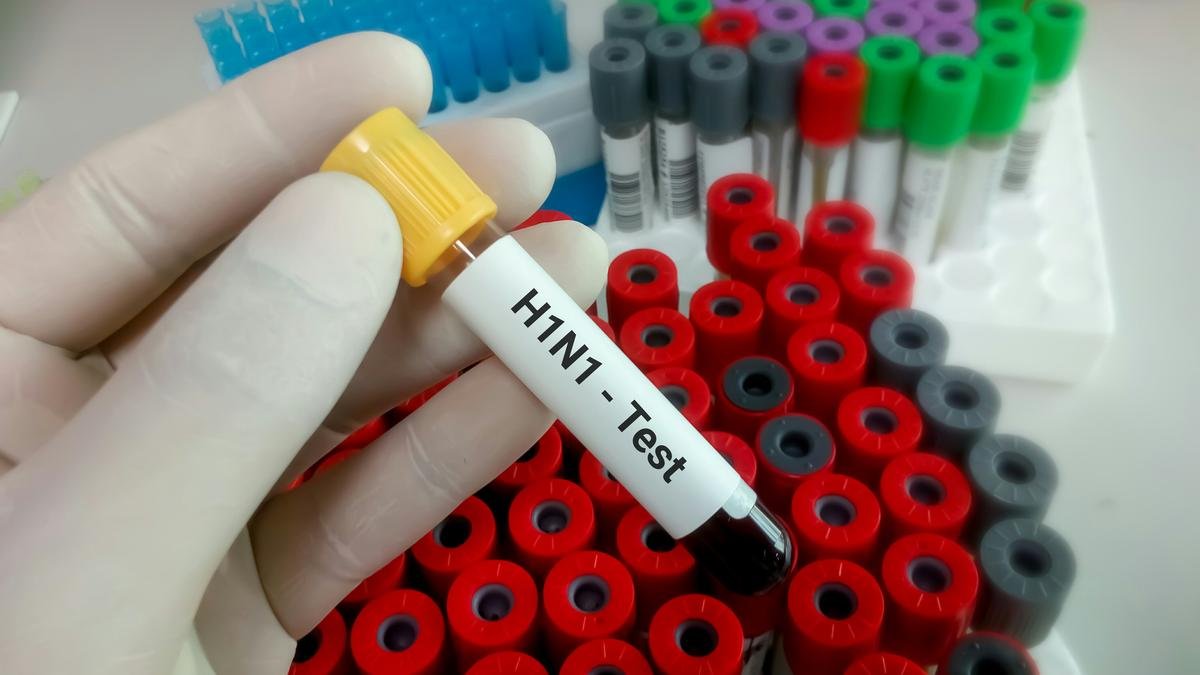 Delhi H1N1 Cases Surge: Delhi Sees Sharp Rise in H1N1 Cases as Doctors Urge Precautions