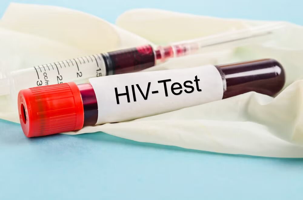Telangana QR HIV Risk Check: Telangana Plans QR Code System for HIV Risk Assessment