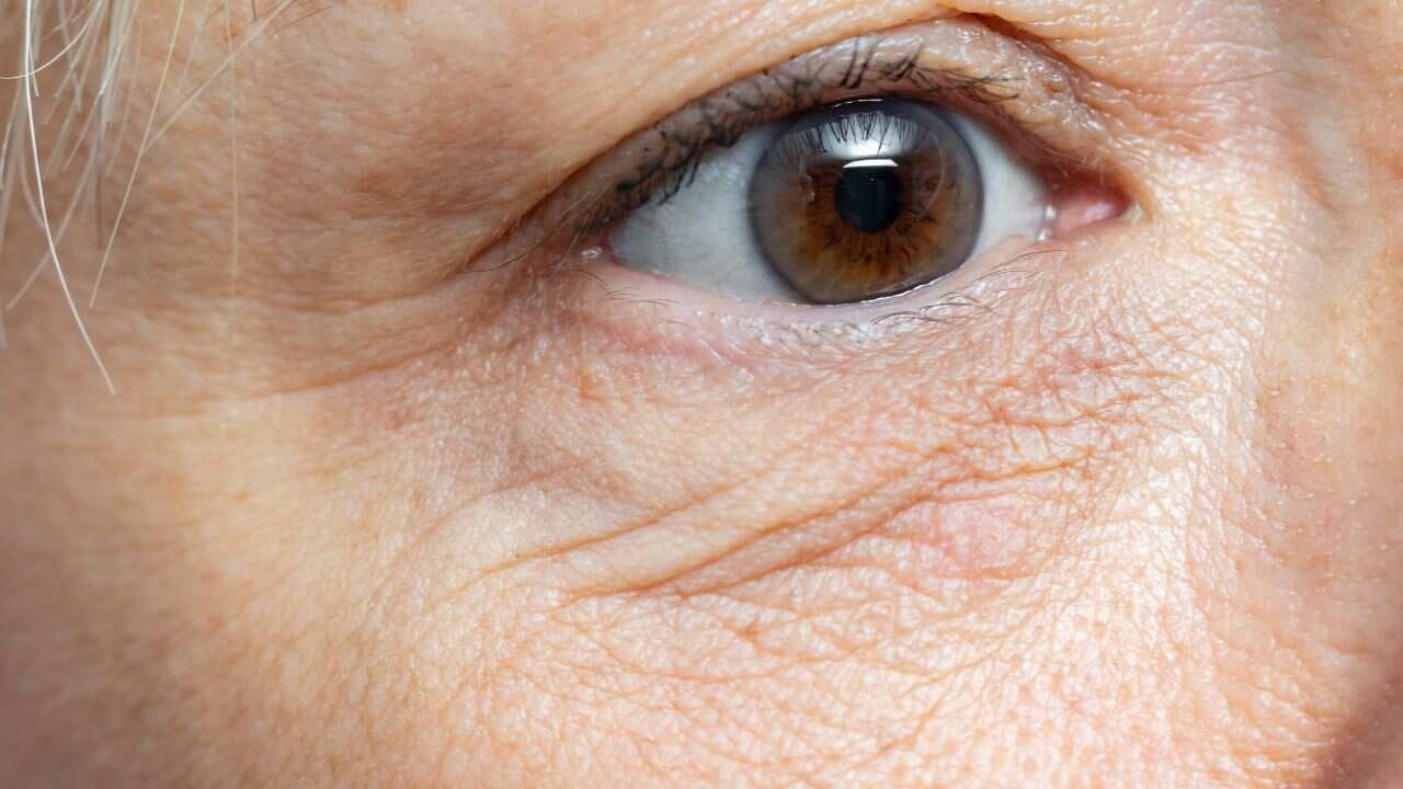 Wrinkles Around Eyes: Why Fine Lines Appear and What Helps