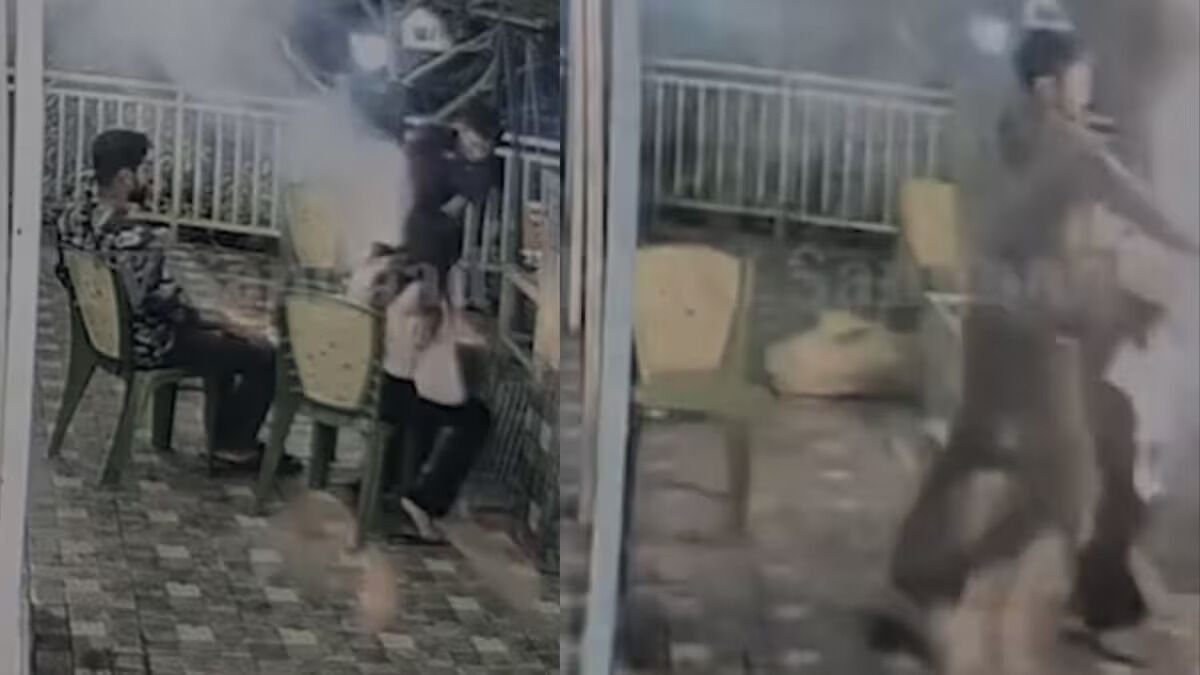Darjeeling Honeymoon Accident: Newlywed Woman Suffers 60% Burns in Barbecue Fire